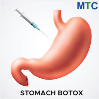 Stomach botox in Turkey