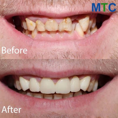 Zadar Dental Work Before & After
