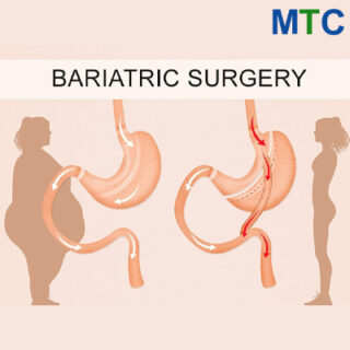 Bariatric surgery in Turkey