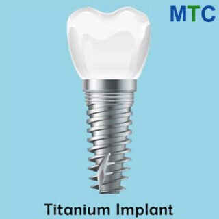 Titanium dental implant in Crete, Greece