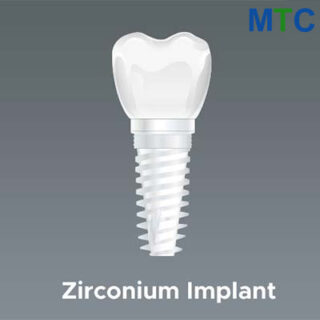 Zirconium dental implant in Crete, Greece