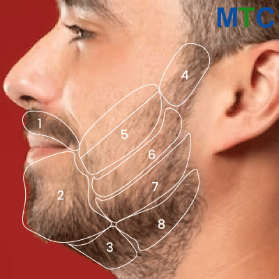 Face Division for Beard Implants