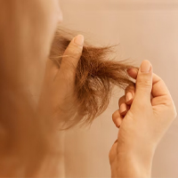 Hair Loss due to Hormonal Havoc