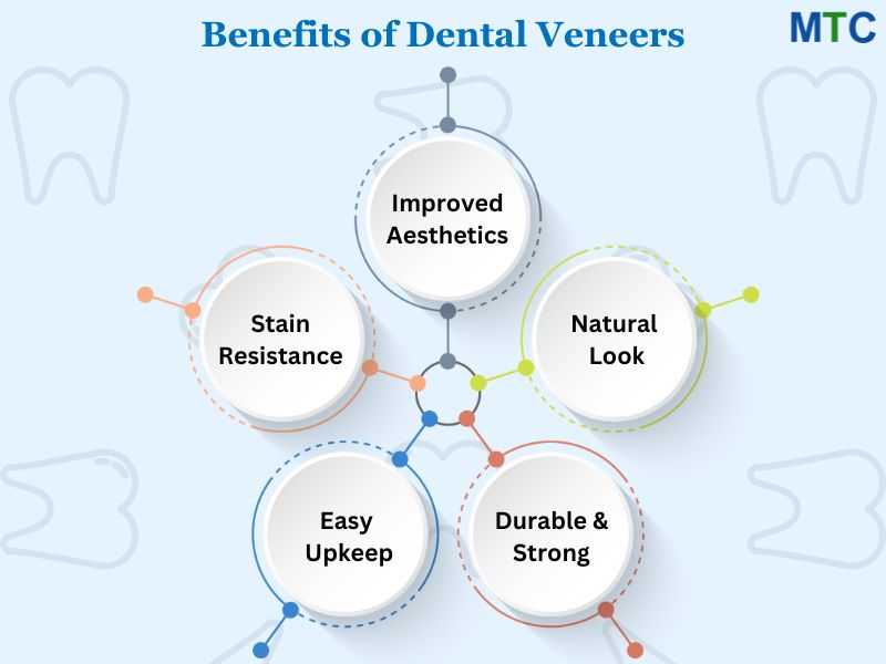 Advantages of Dental Veneers in Los Algodones