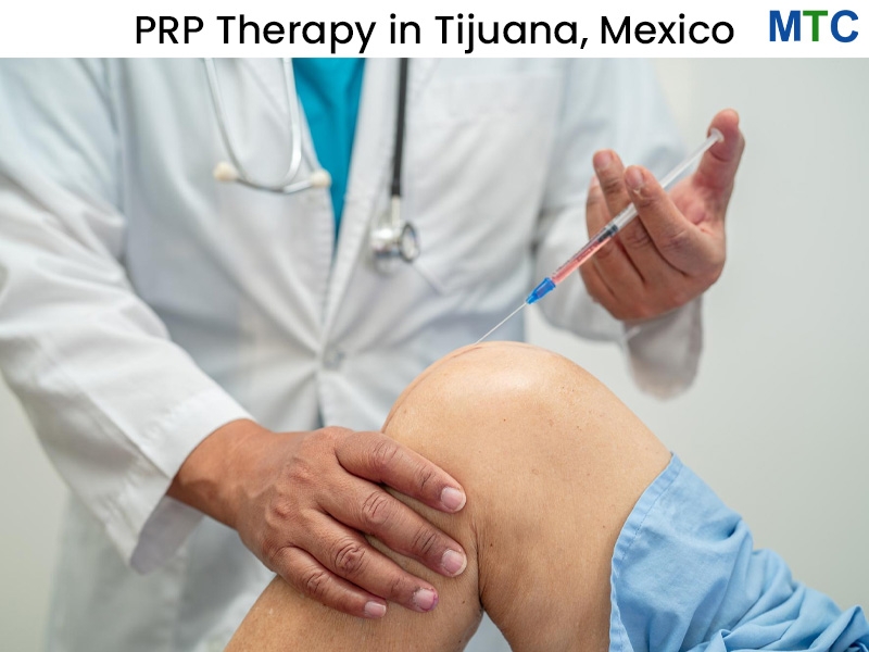 Platelet Rich Plasma (PRP) Therapy in Tijuana, Mexico,