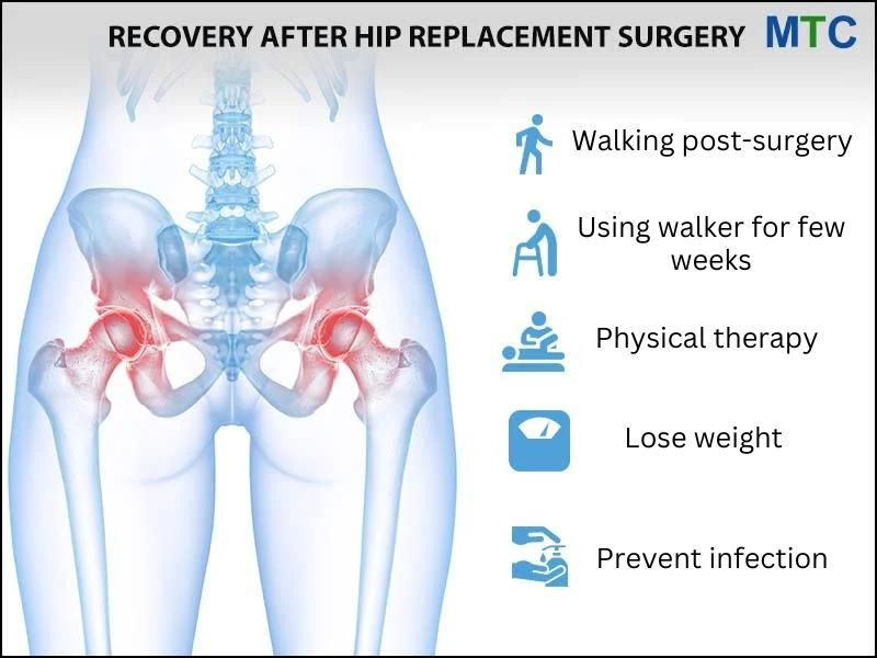 Recovery after Hip replacement in Tijuana, Mexico