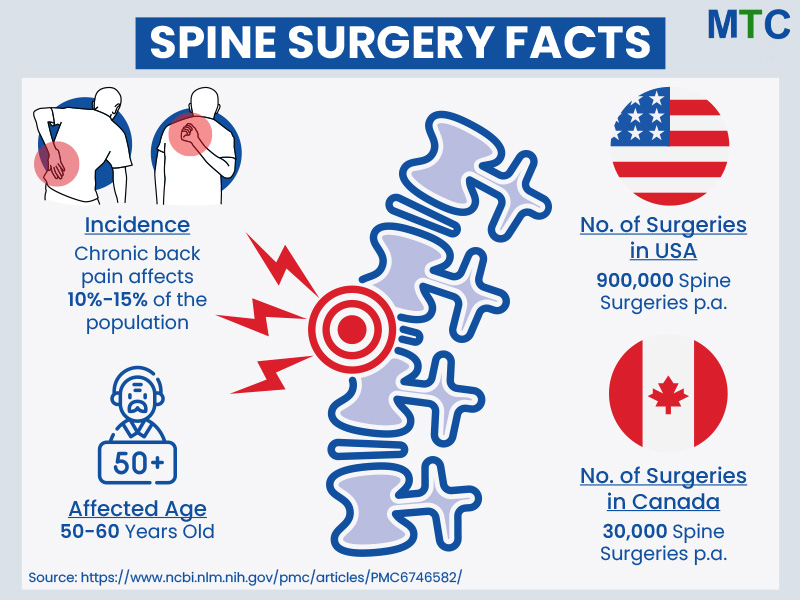 Spine Surgery Facts