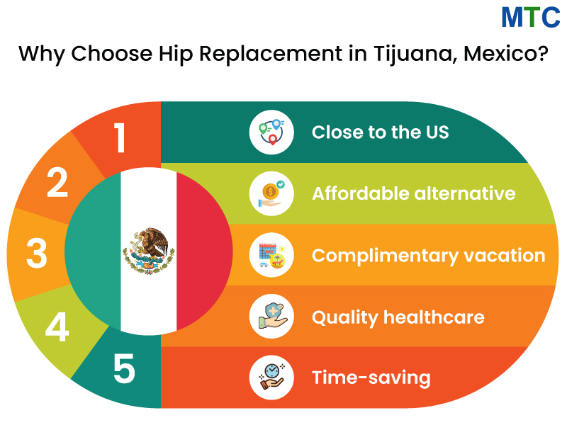 Why choose Hip Replacement in Tijuana, Mexico