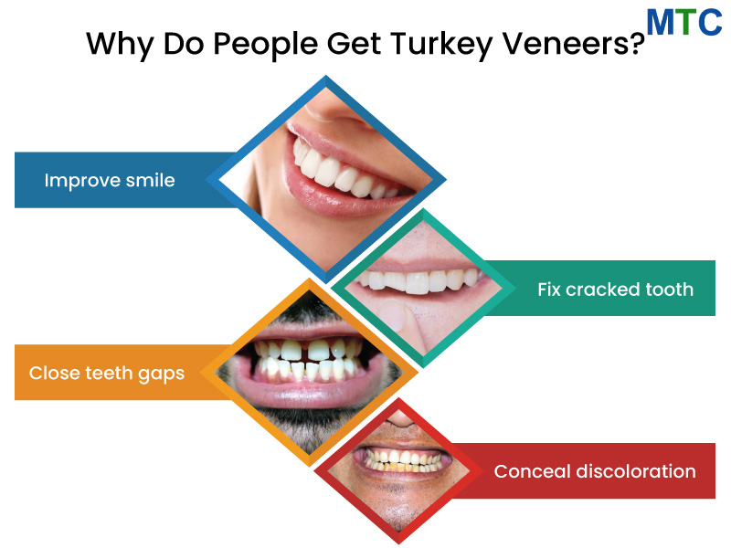Why-Do-People-Get-Turkey-Veneers.jpg