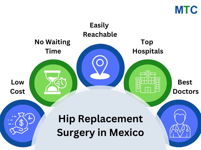 Why choose hip surgery in Mexico?