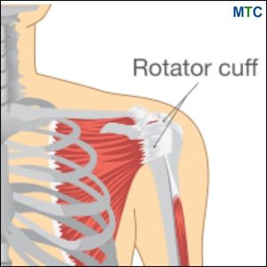 Rotatoir cuff is a group of shoulder muscles