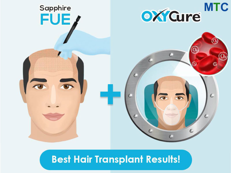 Sapphire FUE & OxyCure Hair Transplant