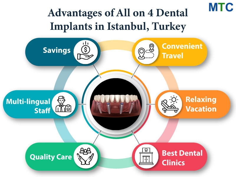 Advantages of All on 4 Dental Implants in Istanbul, Turkey
