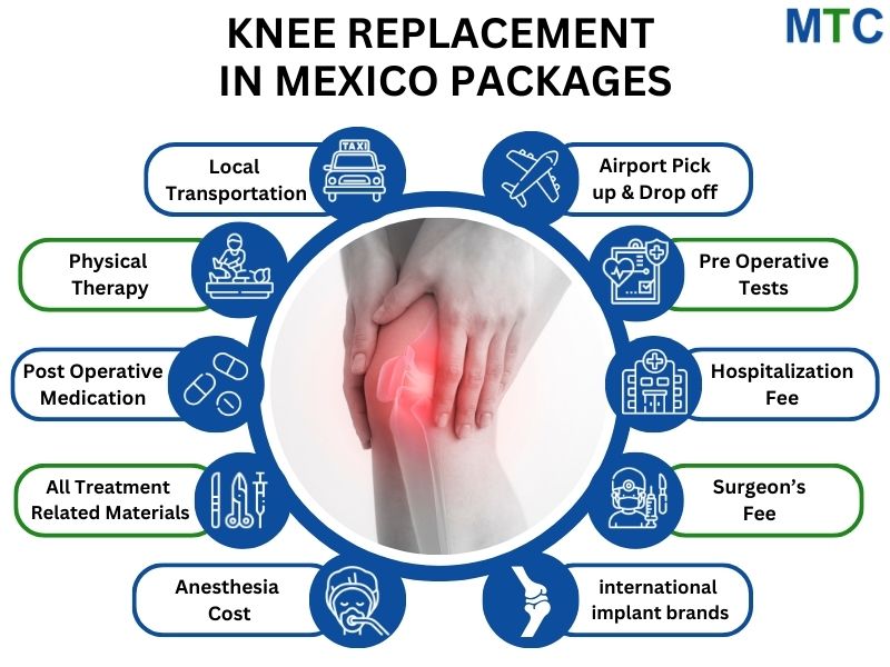 Knee Replacement Surgery Packages in Mexico