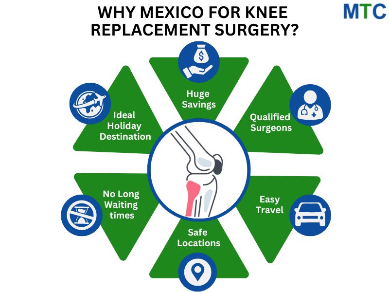 Why Choose Mexico for Knee Replacement