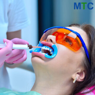 Teeth whitening procedure in Cabo, Mexico