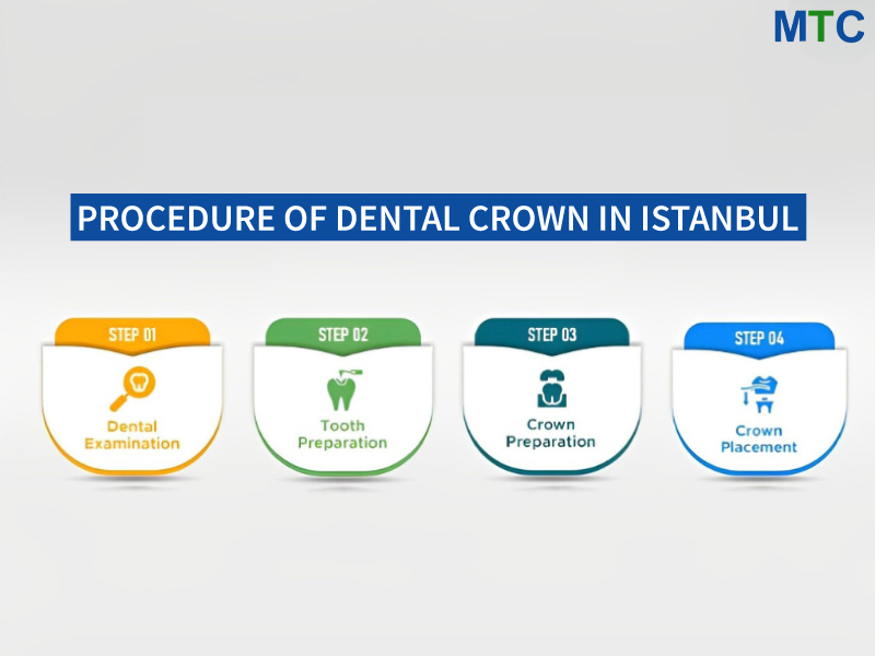 Procedure of dental crown