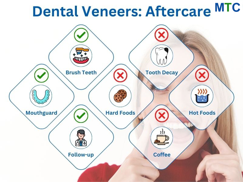 Cancun Dental Veneers Aftercare Tips